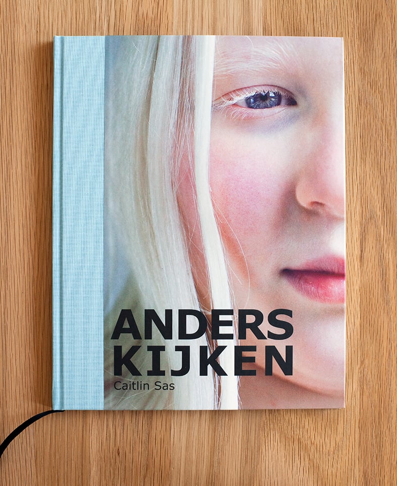 A DIFFERENT LOOK- a closer look on albinism. (ANDERS KIJKEN - albinisme onder de loep)