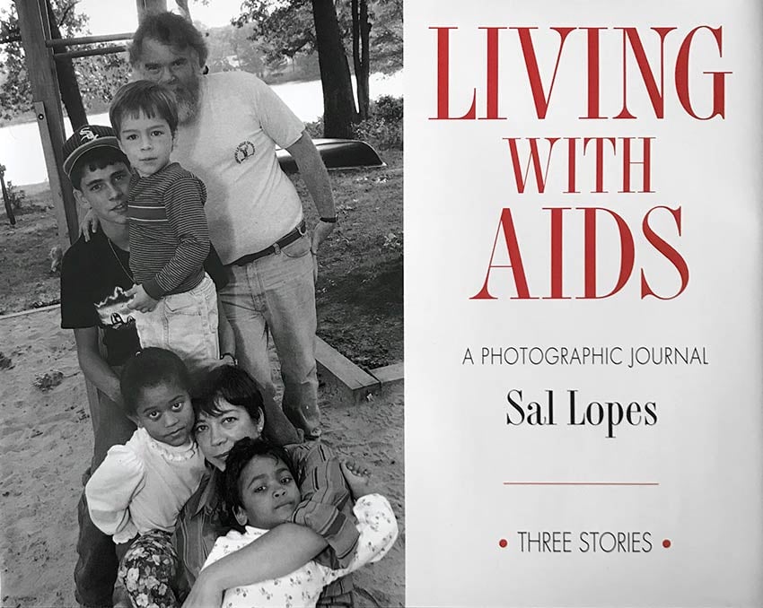 Living with AIDS: Three Essays