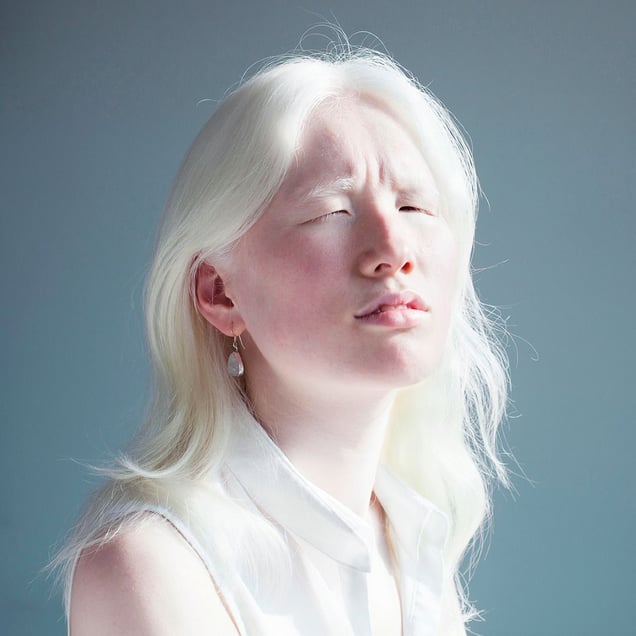 A DIFFERENT LOOK - a closer look on albinism. (ANDERS KIJKEN)