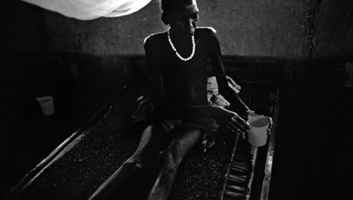 A patient holds a cup of water at the Médecins Sans Frontières  health clinic in the village of Walgak. © Tomas van Houtryve