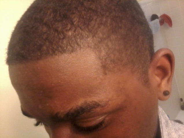 Sharrod selfie (hair line). From the series "I slowly watched him disappear" © Jason Hanasik