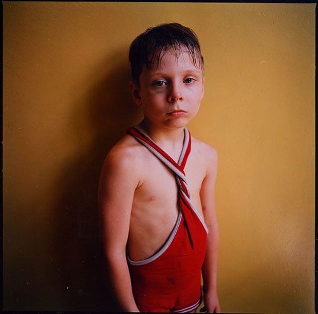 Black Eye, Ukraine, 2006, from Strangely Familiar by Michal Chelbin, Aperture 2008 © Michal Chelbin