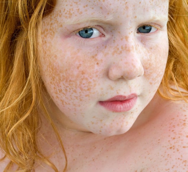 Kim, from the series Natural Red Hair © Hanne van der Woude