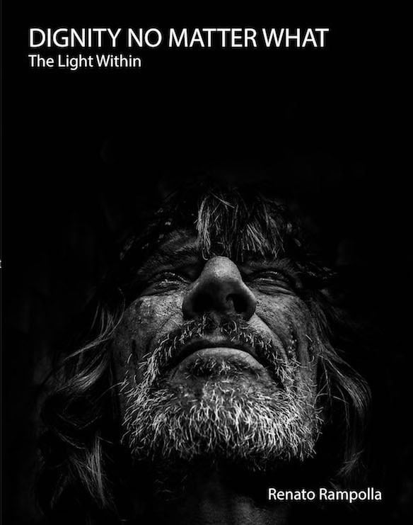 Dignity No Matter What: The Light Within