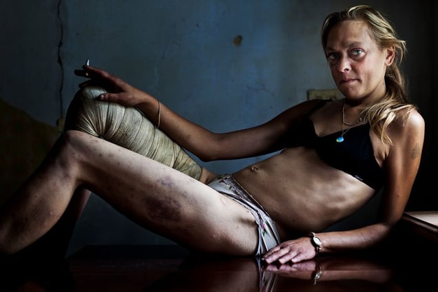 1st prize Contemporary Issues Singles: © Brent Stirton, South Africa, Reportage by Getty Images for Kiev Independent. Kryvyi Rig, Ukraine, 31 August.  Maria, a drug addict and sex worker, in between clients in a room she rents in Kryvyi Rig, Ukraine. Maria injects drugs on a daily basis and sees many men every week but claims she remains HIV negative.