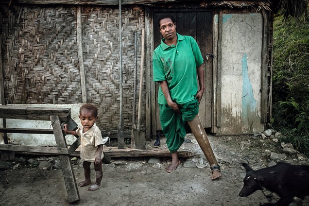 Nineteen-year-old Julie, with her son, shows off her prosthetic leg in front of her house in Kundiawa, Chimbu Province. At the age of nine months, Julie's father attacked her and chopped off her leg. When she went to the city of Lae in 2011 to be fitted for a new prosthetic leg she was raped by members of a local gang and later found out she was pregnant.