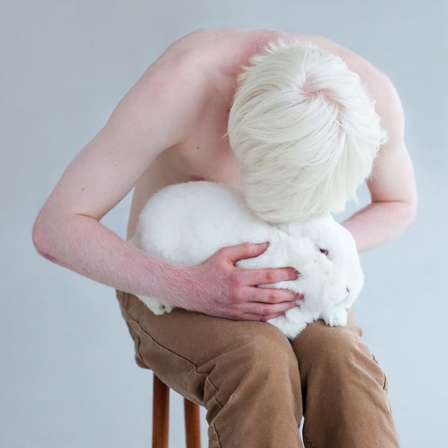 A DIFFERENT LOOK - a closer look on albinism. (ANDERS KIJKEN)