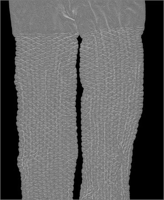 Leggy. © Elaine Duigenan