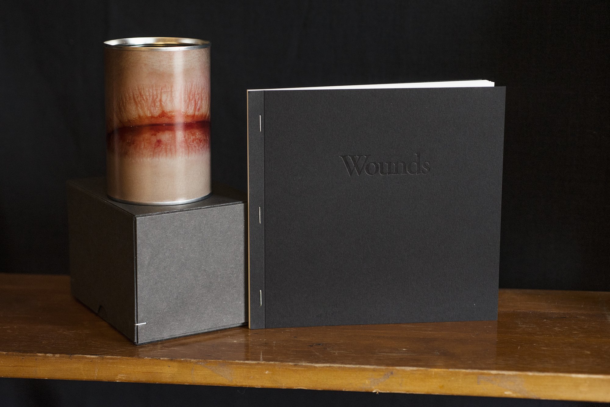 Wounds