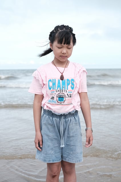 On June 25, 2022, in Zhangzhou City, Fujian Province, China, Chen XinQi is recalling the 
most impressive thing about her treatment for leukemia.