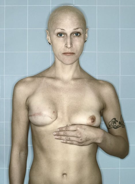 Self-Portrait, Chemo 6th Cycle I, 03.2006