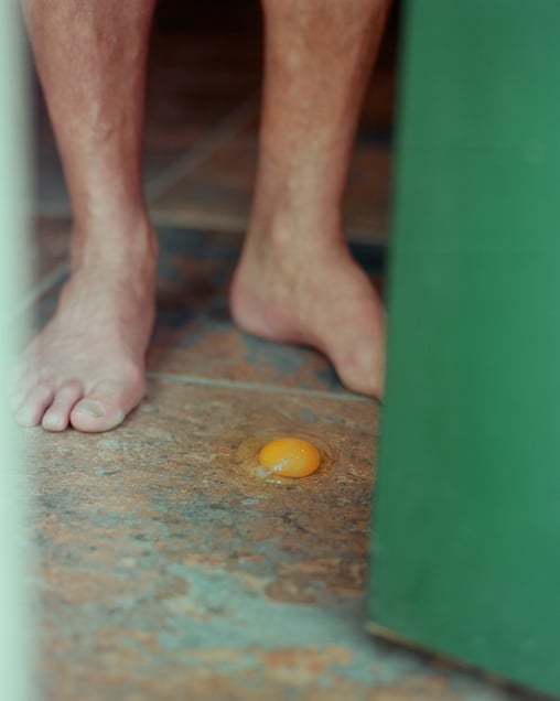 Untitled (Egg and Feet)