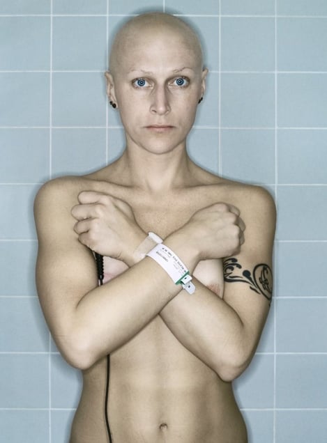 Self-Portrait, Chemo 6th Cycle III, 03.2006