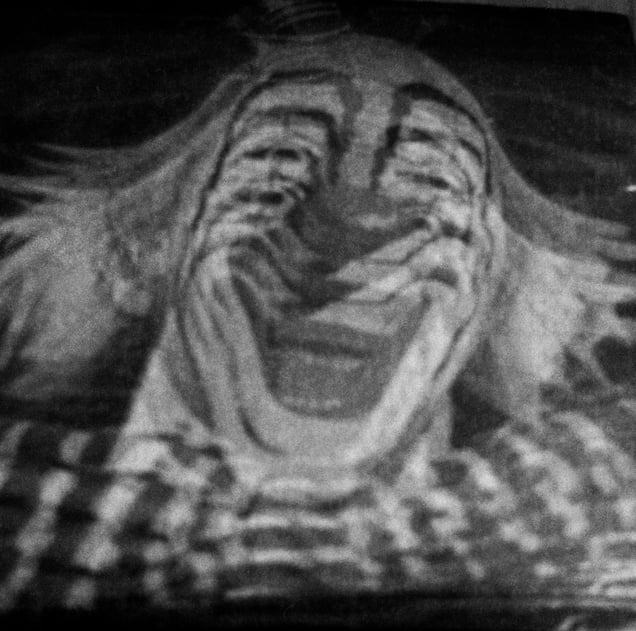 ¨Freaks¨ nº 15