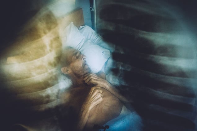 Diagnosis TB © Maxim Dondyuk