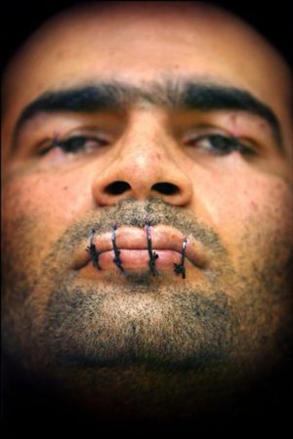 2nd prize People in the News Singles © Paul Vreeker, The Netherlands, Reuters, Protest against deportation. Iranian asylum-seeker Mehdy Kavousi sewed up his lips and eyelids and went on hunger strike to protest against his threatened deportation from the Netherlands, in February.