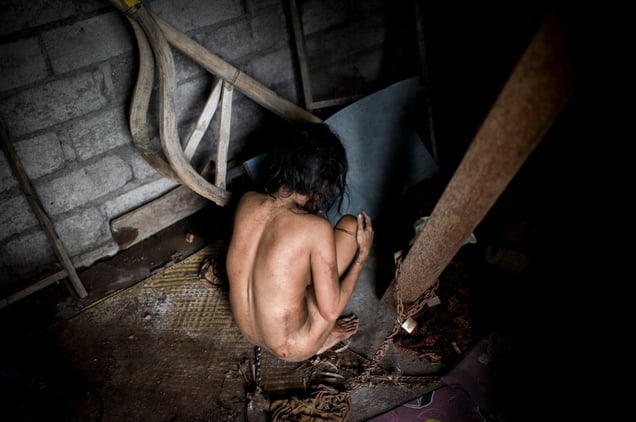 Indonesia, Bali, Singaraja 16. April 2013 - Komang, 26 years old is chained by her family in a hut in the jungle near Singaraja for 8 years. The family says Komang could not handle her divorce. She strayed aimlessly and naked through the village, as the family decidided to put her in chains. © Christian Werner