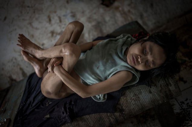 Indonesia, Bali, Singaraja - Kadek, 42, for years she stopped to talk. She has spent more than half her life in a room without windows. Kadek lies on a cot. Her family believes she is possessed by demons. The family refuses that Kadek gets treated with Western medicine. So far They have visited 57 ritual healer, but nothing worked. © Christian Werner