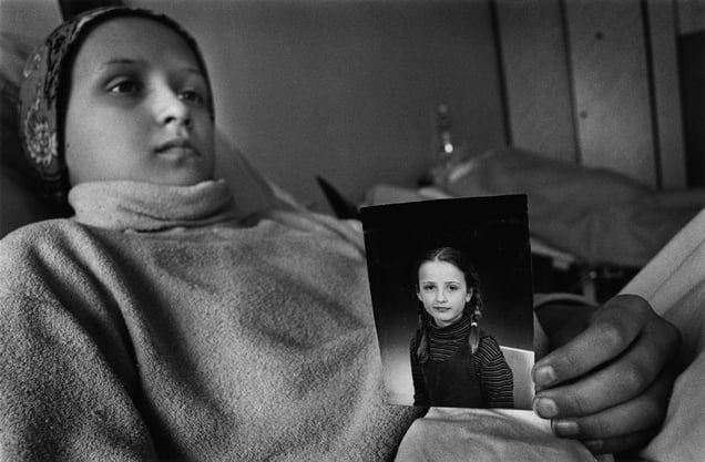 Eugenia,9 years old leukaemia, oncology children's hospital, Lesnoie Borovlyany, Minsk (Belarus) © Pierpaolo Mittica
