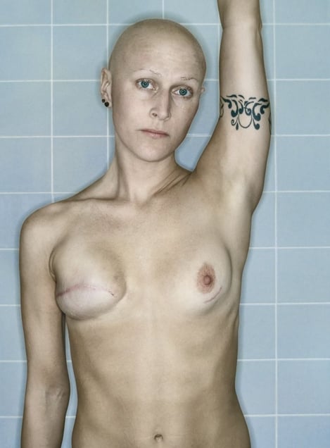 Self-Portrait, Chemo 7th Cycle V, 04.2006