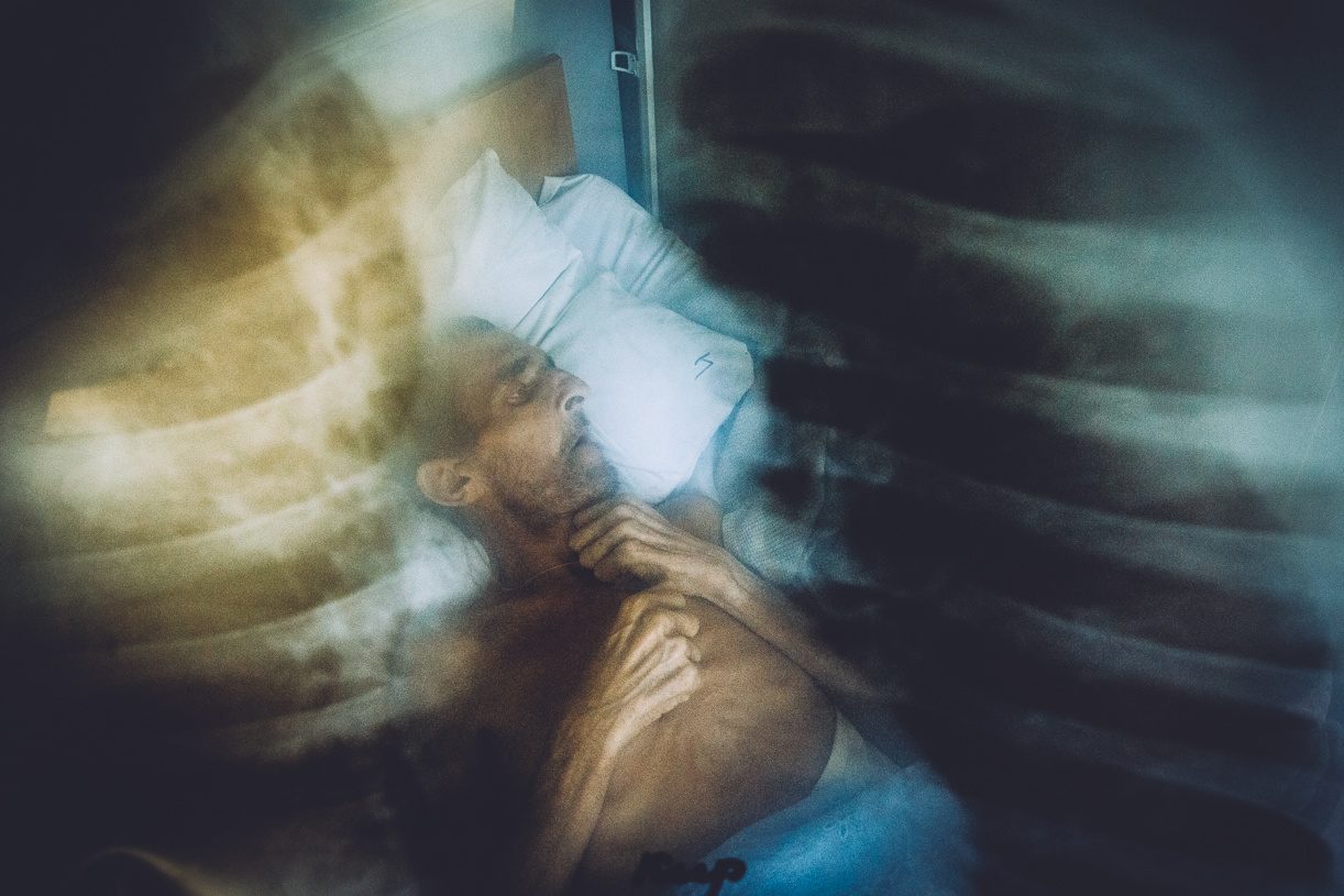 TB Epidemic in Ukraine