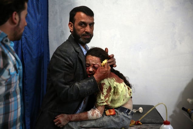 A wounded Syrian girl holds on to a relative as she awaits treatment by doctor sat a makeshift hospital in Douma, Syria, 11 May 2015.