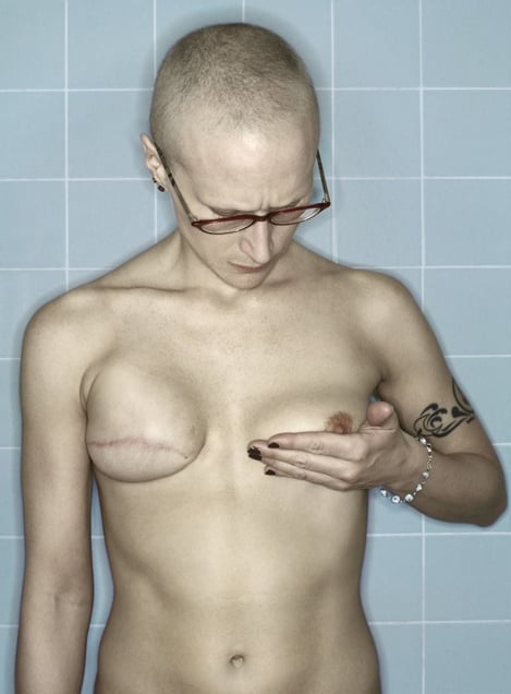 Self-Portrait, Tamoxifen Recovery II, 05.2006