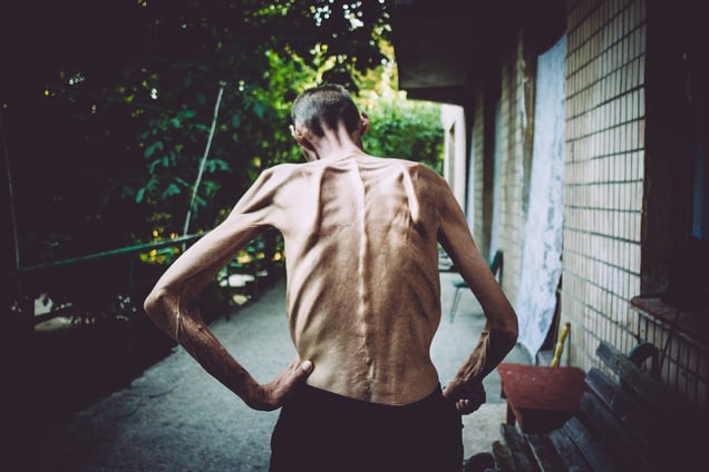 Gena, 1969. Diagnosis: MDR TB + HIV.  Kherson, July 2011.