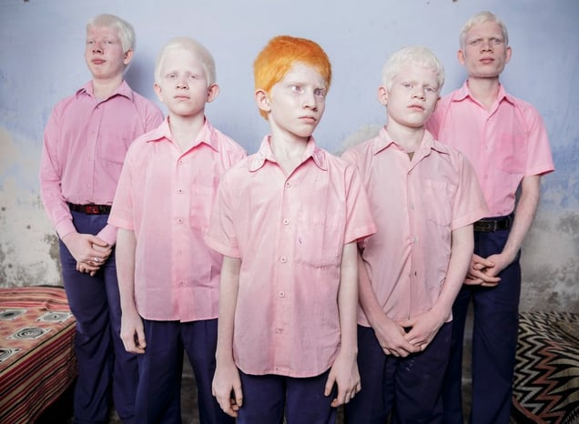 1st Prize People – Staged Portraits Single. A group of blind albino boys photographed in their boarding room at the Vivekananda mission school for the blind in West Bengal, India. This is one of the very few schools for the blind in India today © Brent Stirton, South Africa, Reportage by Getty Images