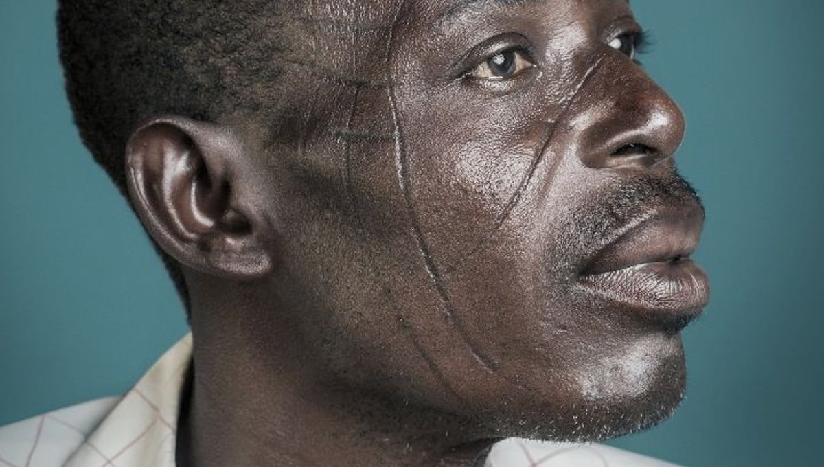 Mr. Pousnouaga :  "It was like an identity card in my family. Each tribe has their scars.” © Joana Choumali