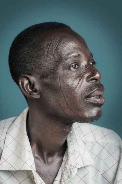 Mr. Pousnouaga :  "It was like an identity card in my family. Each tribe has their scars.” © Joana Choumali