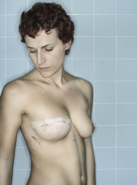 Self-Portrait, Post-Reconstruction I, 12.2006