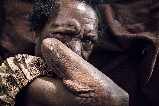 Rasta was accused of sorcery by her neighbors after the death of a local young man. She was set upon by a crowd at his funeral and beaten and strangled before she escaped. She lost her hand in the attack.