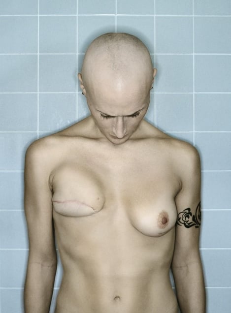 Self-Portrait, Chemo 3rd Cycle, 02.2006