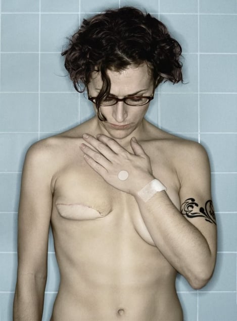 Self-Portrait, Chemo 1st Cycle I, 01.2006