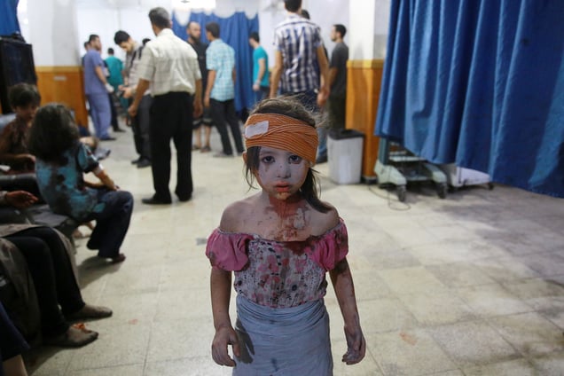 A wounded Syrian girl at a makeshift hospital in Douma, Syria, 22 August 2015.