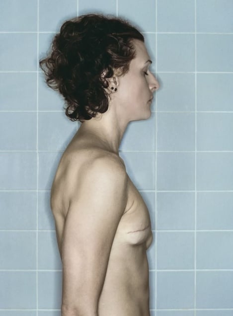 Self-Portrait, Chemo 1st Cycle II, 01.2006