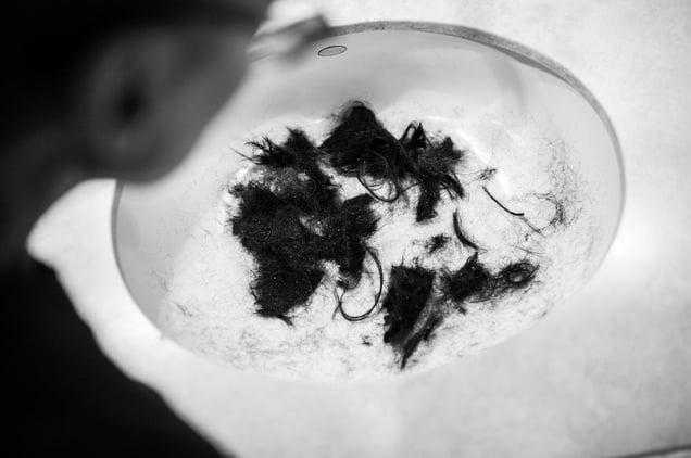 After three breast cancer diagnoses, and undergoing chemotherapy treatment multiple times, losing her hair for a third time seemed inevitable and unfair to Laurel Borowick. Cancer has taken her breast and her hair, leaving her feeling like she no longer looks like a woman anymore. Chappaqua, New York. February, 2013 © Nancy Borowick