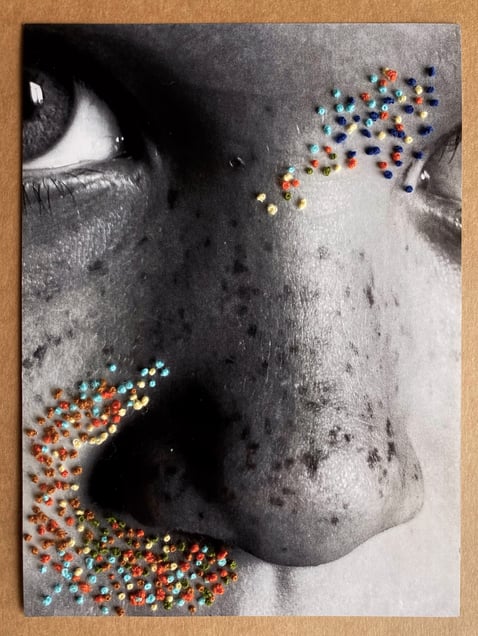 Freckles
