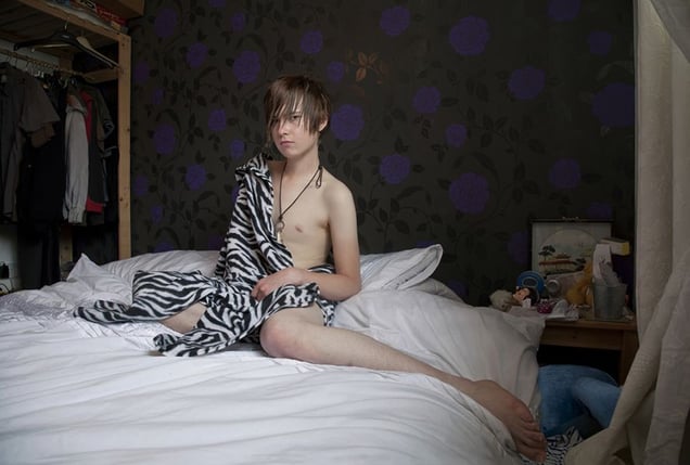 Olli, 19 years. Recovering anorexia. From the series "In My Skin" © Michelle Sank