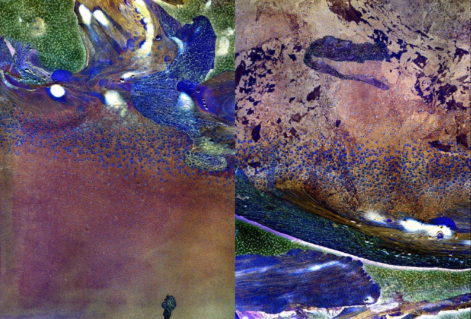 MATTER / BURN OUT - LensCulture