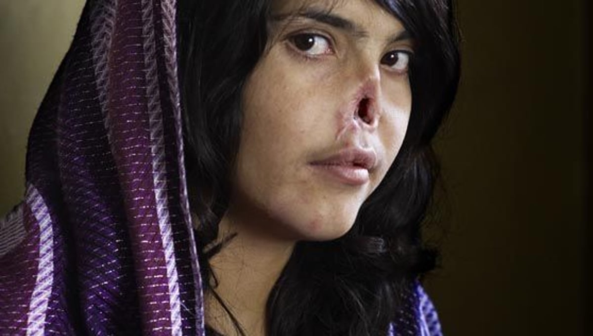 World Press Photo of the Year 2010 © Jodi Bieber, South Africa, Institute for Artist Management/Goodman Gallery for Time magazine. Bibi Aisha, an 18-year-old woman from Oruzgan province in Afghanistan, who fled back to her family home from her husbands house, complaining of violent treatment. The Taliban arrived one night, demanding Bibi be handed over to face justice, and cut off her nose.