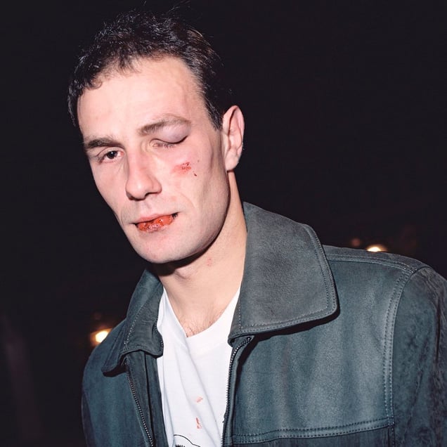 After an Estonian-Russian street fight, 02.35  from the series BATTERED (2006-2007). © Harri Pälviranta