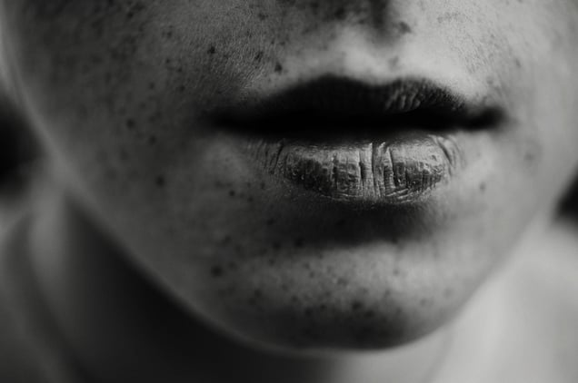 Chapped Lips