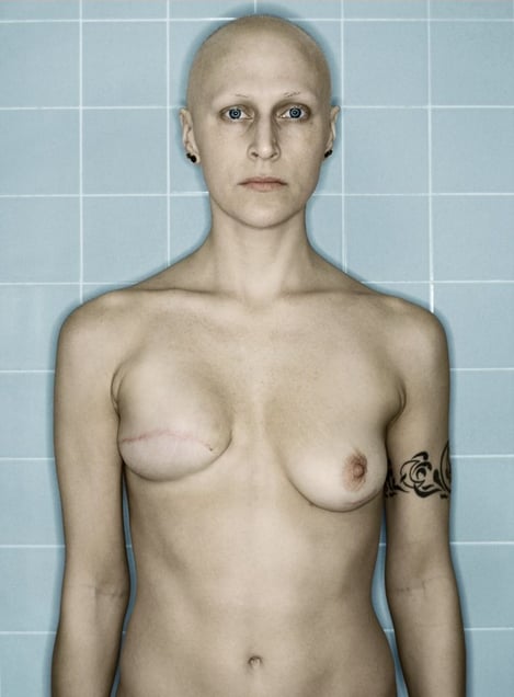 Self-Portrait, Chemo 7th Cycle VI, 04.2006