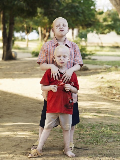 Idd & Abruhan HANZIRUNI