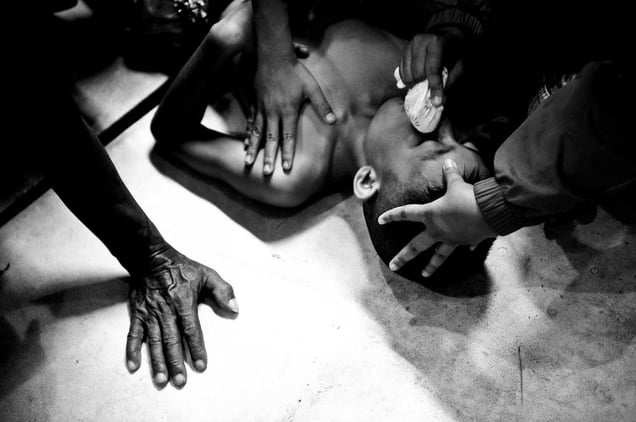 Injured boy after the boxing match. © Sandra Hoyn