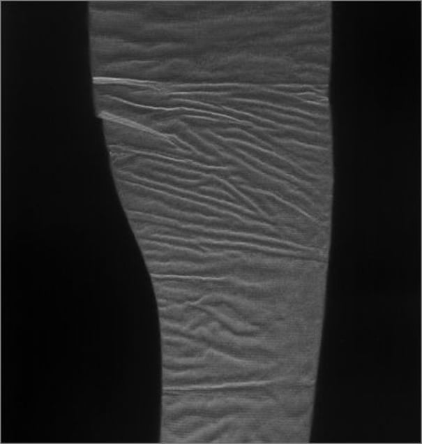 Second Skin. © Elaine Duigenan