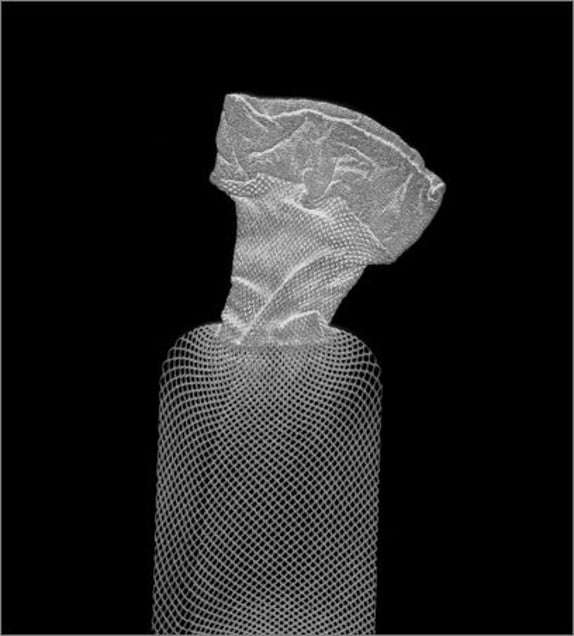 Knee High. © Elaine Duigenan