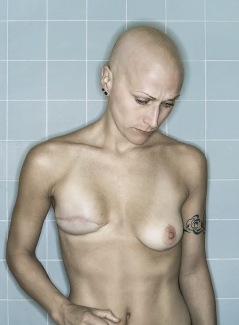 Self-Portrait, Chemo 5th Cycle I, 03.2006